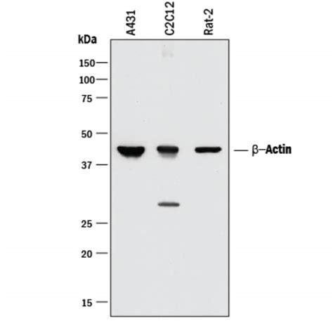 beta actin kda|Human/Mouse/Rat beta .